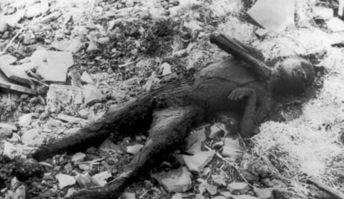 Hiroshima Victim - Yosuke Yamahata - Japanese News and Information Bureau Abbildung von der Leiche eines Opfers der Atombome 1945 Hiroshima